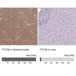 TTC7B Antibody, Novus Biologicals:Antibodies:Primary Antibodies